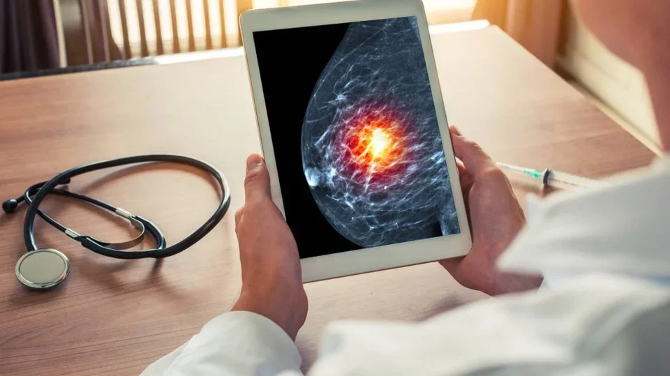 Doctor looking at a mammogram on tablet