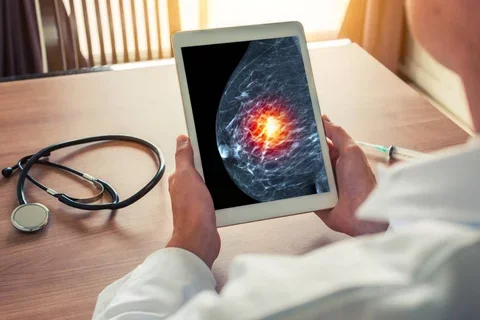 Doctor looking at a mammogram on tablet