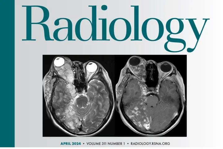 Journal Cover: Radiology Vol. 311, No. 1 (April 2024)