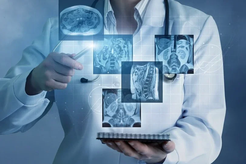 Doctor holding x-rays