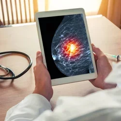 Doctor looking at a mammogram on tablet