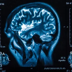 The X-ray of the human brain closeup
