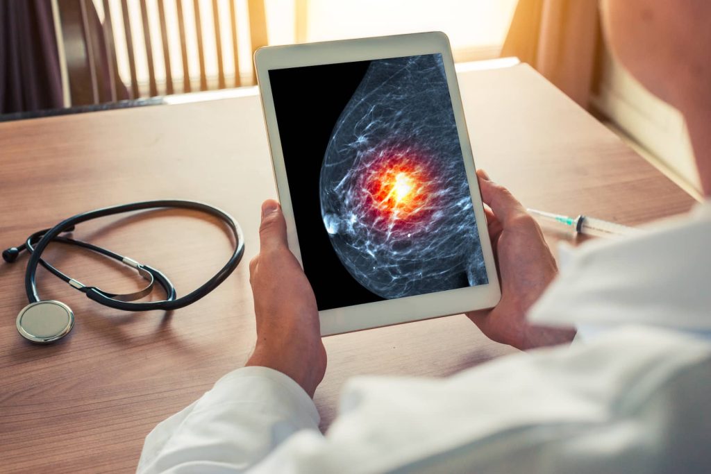 Doctor looking at image of a mammogram on tablet